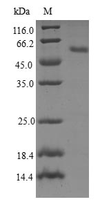 Greater than 90% as determined by SDS-PAGE.Recombinant Human Ras-Related Protein Rab-23 (RAB23) Protein (GST)