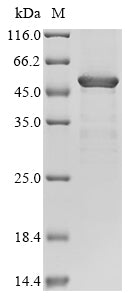 Greater than 90% as determined by SDS-PAGE.Recombinant Human Protein Mono-Adp-Ribosyltransferase Parp4 (PARP4) Protein (His)