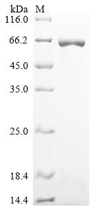Greater than 85% as determined by SDS-PAGE.Recombinant Human Atp-Dependent Rna Helicase Ddx19B (DDX19B) Protein (His&Myc), Active