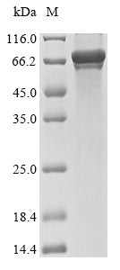 Greater than 85% as determined by SDS-PAGE.Recombinant Mouse E3 Ubiquitin-Protein Ligase Parkin (PRKN) Protein (GST)