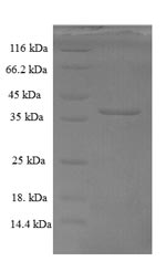 Greater than 90% as determined by SDS-PAGE.