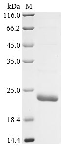 Greater than 85% as determined by SDS-PAGE.Recombinant Mouse Inositol 1,4,5-Triphosphate Receptor Associated 1 (IRAG1) Protein (His&Myc)