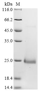Greater than 90% as determined by SDS-PAGE.Recombinant Mouse C-X-C Motif Chemokine 15 (CXCL15) Protein (His&Myc)