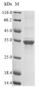 Greater than 85% as determined by SDS-PAGE.Recombinant Mouse Troponin I, Slow Skeletal Muscle (TNNI1) Protein (His-Flag&Myc)
