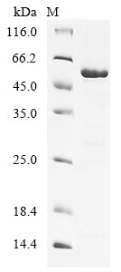 Greater than 85% as determined by SDS-PAGE.Recombinant Human Serine/Threonine-Protein Kinase 38-Like (STK38L) Protein (GST)