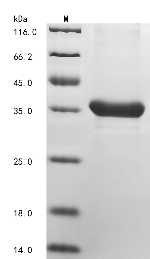 Greater than 85% as determined by SDS-PAGE.Recombinant Human Serine/Threonine-Protein Kinase 38-Like (STK38L) Protein (His)