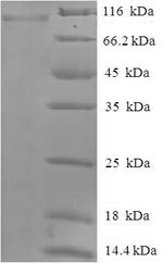 Greater than 90% as determined by SDS-PAGE.