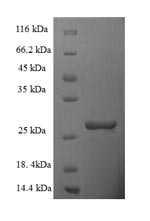 Greater than 90% as determined by SDS-PAGE.