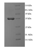 Greater than 90% as determined by SDS-PAGE.