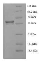 Greater than 90% as determined by SDS-PAGE.