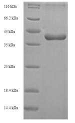 Greater than 90% as determined by SDS-PAGE.Recombinant Mouse Ccn Family Member 5 (CCN5) Protein (His-SUMO)
