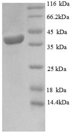 Greater than 90% as determined by SDS-PAGE.