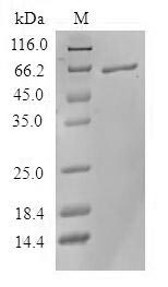 Greater than 90% as determined by SDS-PAGE.Recombinant Human Serine-Threonine Kinase Receptor-Associated Protein (STRAP) Protein (GST)