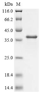 Greater than 85% as determined by SDS-PAGE.Recombinant Human Preli Domain-Containing Protein 1, Mitochondrial (PRELID1) Protein (His-SUMO)