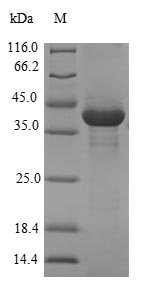 Greater than 90% as determined by SDS-PAGE.Recombinant Human Protein Chibby Homolog 1 (CBY1) Protein (GST)