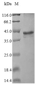 Greater than 85% as determined by SDS-PAGE.Recombinant Human Small Kinetochore-Associated Protein (KNSTRN) Protein (His)