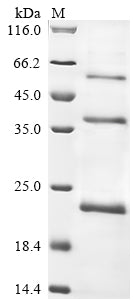 Greater than 85% as determined by SDS-PAGE.Recombinant Human Atrial Natriuretic Peptide-Converting Enzyme (CORIN) Protein (His)
