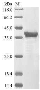 Greater than 85% as determined by SDS-PAGE.Recombinant Human Protein Patched Homolog 2 (PTCH2) Protein (His&Myc)