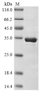 Greater than 85% as determined by SDS-PAGE.Recombinant Human Zinc Finger And Btb Domain-Containing Protein 32 (ZBTB32) Protein (His)