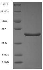 Greater than 90% as determined by SDS-PAGE.Recombinant Human Calmodulin-Like Protein 5 (CALML5) Protein (His-SUMO)