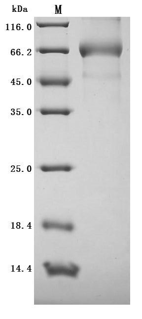 Greater than 95% as determined by SDS-PAGE.Recombinant Human Intestinal-Type Alkaline Phosphatase (ALPI) Protein (His), Active