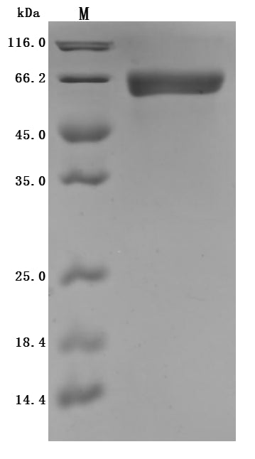 Greater than 95% as determined by SDS-PAGE.Recombinant Rat Intestinal-Type Alkaline Phosphatase 1 (ALPI) Protein (His), Active