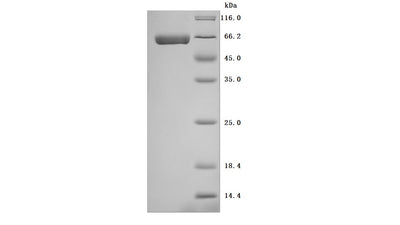 Greater than 95% as determined by SDS-PAGE.Recombinant Human Alkaline Phosphatase, Germ Cell Type (ALPG) Protein (His), Active