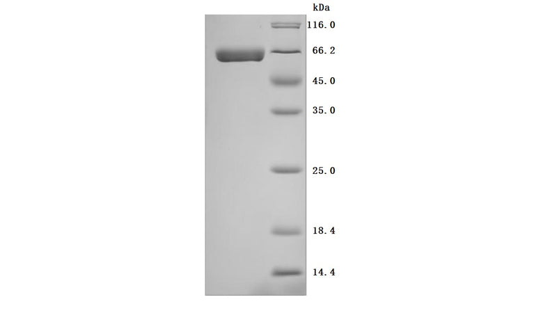 Greater than 95% as determined by SDS-PAGE.Recombinant Human Alkaline Phosphatase, Germ Cell Type (ALPG) Protein (His), Active