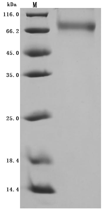 Greater than 95% as determined by SDS-PAGE.Recombinant Dog Angiopoietin-2 (ANGPT2) Protein (His), Active