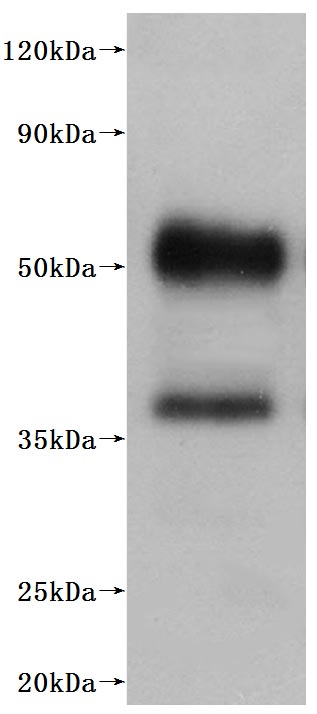 this product is detected by Mouse anti-6*His monoclonal antibody.Recombinant Human C5A Anaphylatoxin Chemotactic Receptor 1 (C5AR1) Protein (His), Active