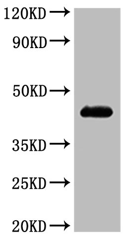 this product is detected by Mouse anti-6*His monoclonal antibody.Recombinant Human C-C Chemokine Receptor Type 4 (CCR4) Protein (His), Active