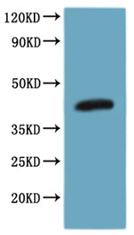 this product is detected by Mouse anti-6*His monoclonal antibody.Recombinant Human C-C Chemokine Receptor Type 8 (CCR8) Protein (His), Active
