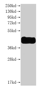 this product is detected by Anti-CCR8 recombinant AntibodyRecombinant Human C-C Chemokine Receptor Type 8 (CCR8) Protein (His), Active