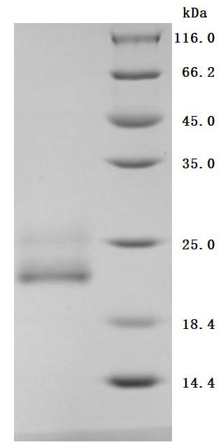 Greater than 95% as determined by SDS-PAGE.Recombinant Human Early Activation Antigen Cd69 (CD69) Protein (His), Active