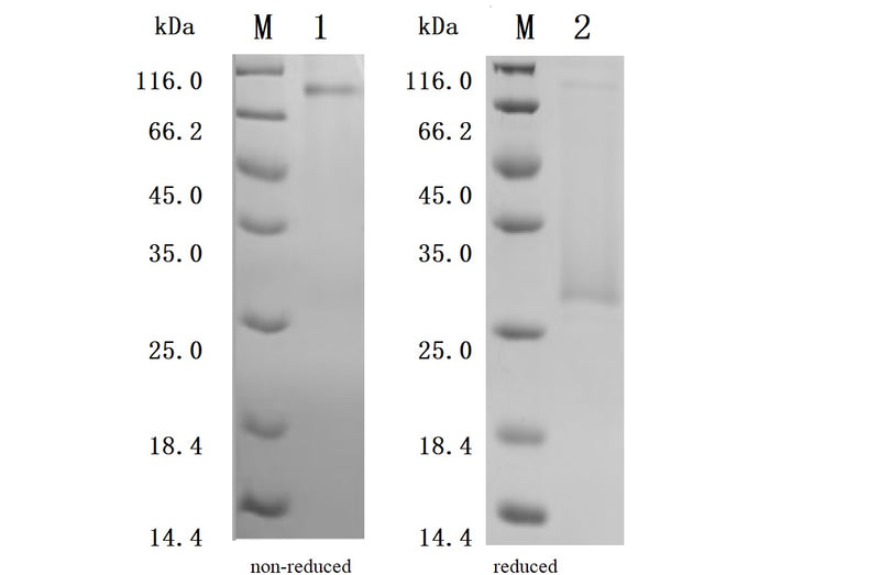Greater than 92.5% as determined by SDS-PAGE.Recombinant Human Cd70 Antigen (CD70) Protein (His), Active