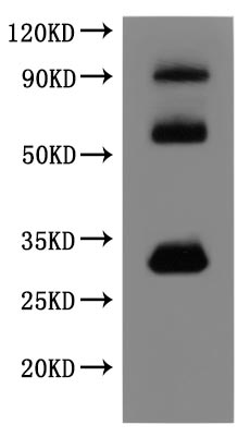 Western Blot this product is detected by Mouse anti-6*His monoclonal antibody.The three bands respectively correspond to monomer, Homodimer, Homotrimer