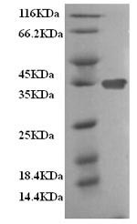 Greater than 90% as determined by SDS-PAGE.Recombinant Mouse Clathrin Light Chain A (CLTA) Protein (His&Flag)