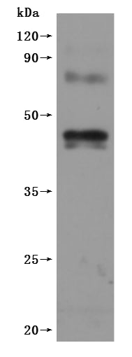this product is detected by Mouse anti-6*His monoclonal antibody.Recombinant Human Cannabinoid Receptor 1 (CNR1) Protein (His), Active