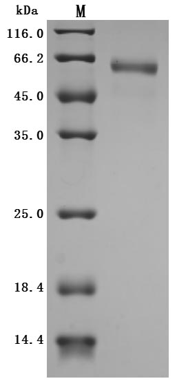 Greater than 95% as determined by SDS-PAGE.Recombinant Human Cytokine Receptor Common Subunit Beta (CSF2RB) Protein (His), Active