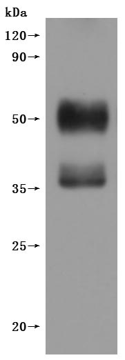 this product is detected by Mouse anti-6*His monoclonal antibody.