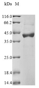 Greater than 85% as determined by SDS-PAGE.Recombinant Rat D-Amino-Acid Oxidase (DAO) Protein (His&Myc)