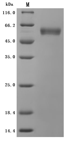 Greater than 95% as determined by SDS-PAGE.Recombinant Human Epithelial Discoidin Domain-Containing Receptor 1 (DDR1) Protein (His), Active