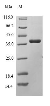 Greater than 90% as determined by SDS-PAGE.Recombinant Human Protein Delta Homolog 1 (DLK1) Protein (Flag-Myc)
