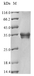 Greater than 85% as determined by SDS-PAGE.Recombinant Rat Endothelin-1 (EDN1) Protein (hFc-Myc)