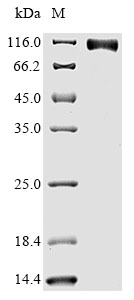 Greater than 90% as determined by SDS-PAGE.Recombinant Human Epidermal Growth Factor Receptor (EGFR) Protein (His&Myc), Active