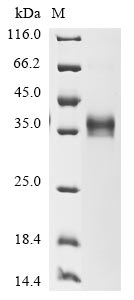 Greater than 85% as determined by SDS-PAGE.Recombinant Mouse Epithelial Cell Adhesion Molecule (EPCAM) Protein (His&Myc)