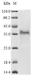 Greater than 85% as determined by SDS-PAGE.
