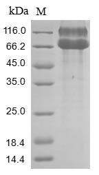 Greater than 85% as determined by SDS-PAGE.Recombinant Human Ephrin Type-A Receptor 2 (EPHA2) Protein (His&Myc)