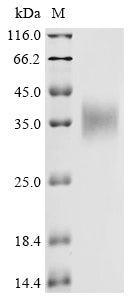 Greater than 85% as determined by SDS-PAGE.