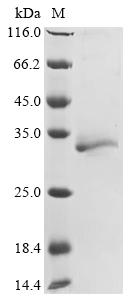 Greater than 85% as determined by SDS-PAGE.Recombinant Rat Erythropoietin Receptor (EPOR) Protein (His)